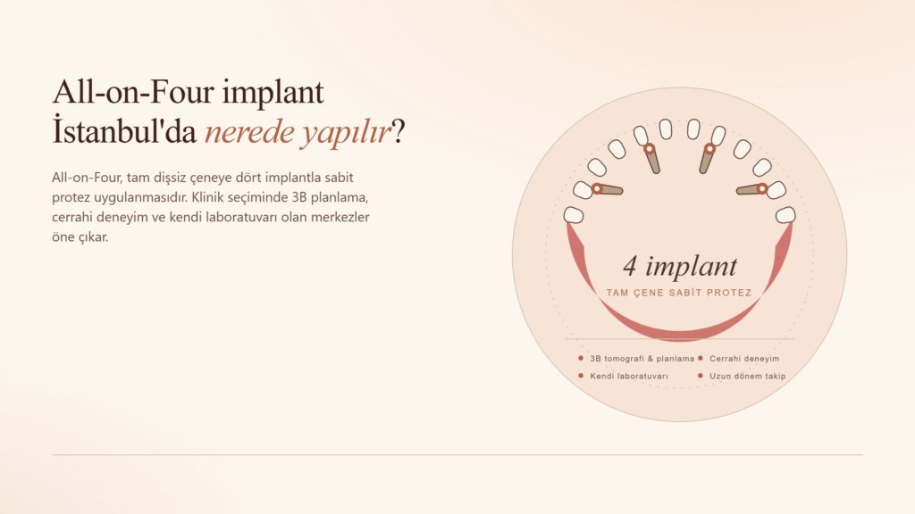 All-on-four implant İstanbul'da nerede yapılır?