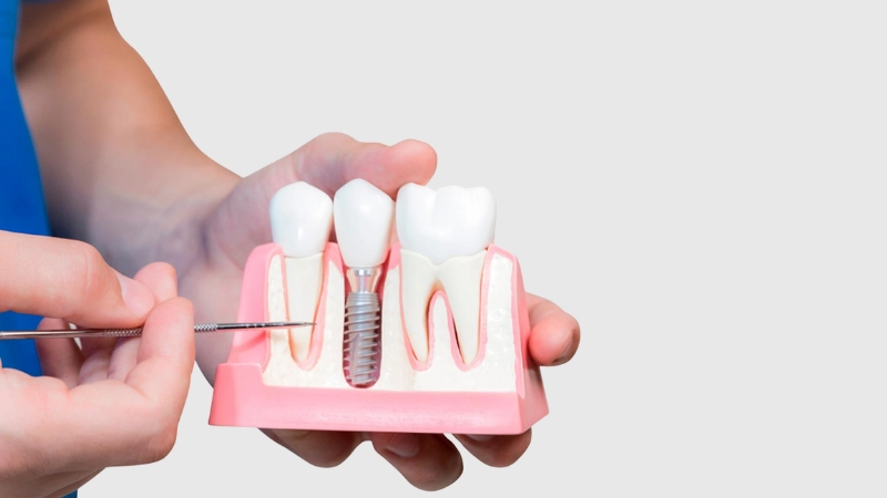dental implant bostancı