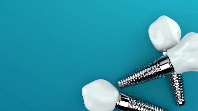 dental implant fiyatları global