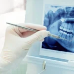 3 Boyutlu Diş Tomografisi (CBCT) Nedir?