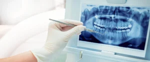 3 Boyutlu Diş Tomografisi (CBCT) Nedir?
