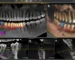 3 Boyutlu Diş Tomografisi (CBCT) Nedir?