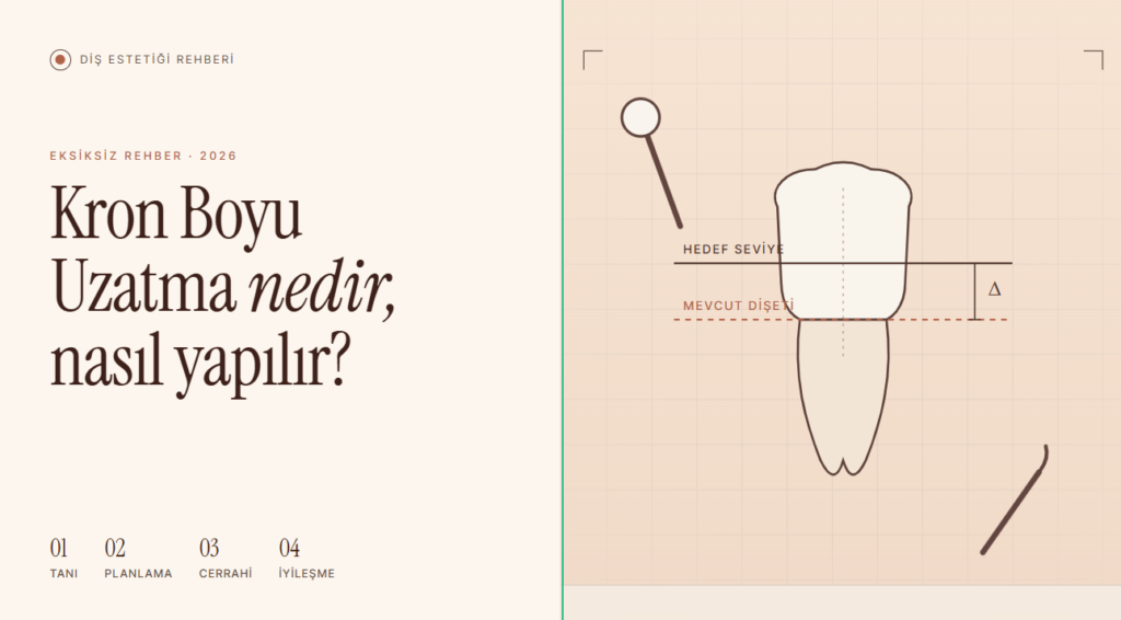 Kron Boyu Uzatma Nedir, Nasıl Yapılır? Eksiksiz Rehber
