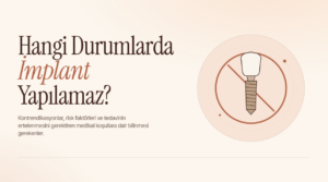 Hangi Durumlarda İmplant Yapılamaz?