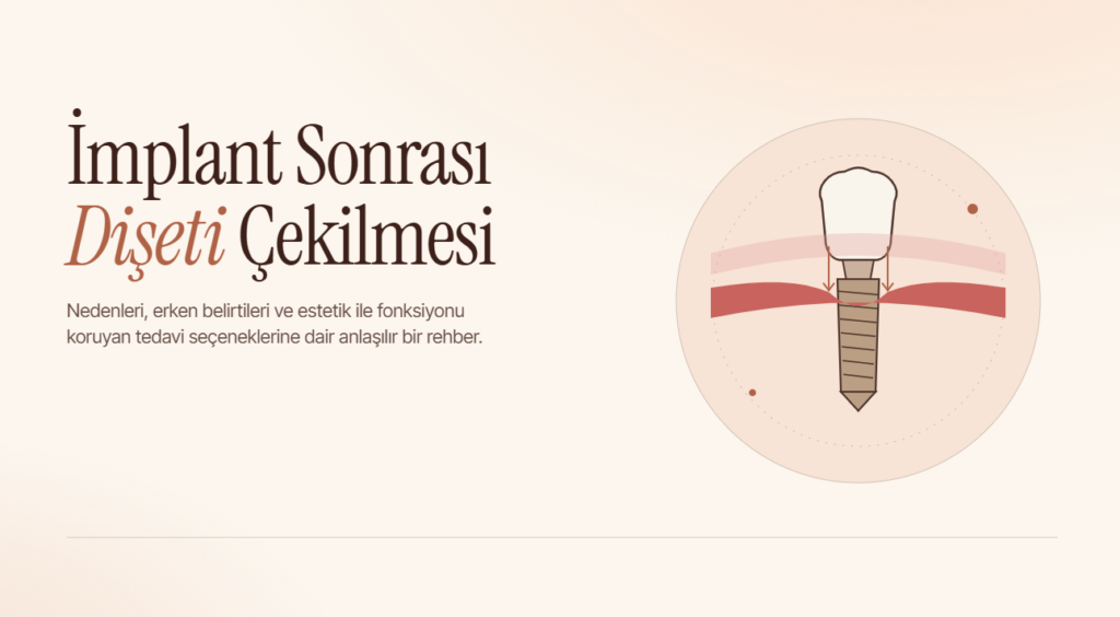 İmplant Sonrası Dişeti Çekilmesi