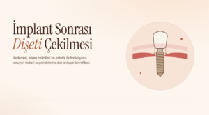 İmplant Sonrası Dişeti Çekilmesi