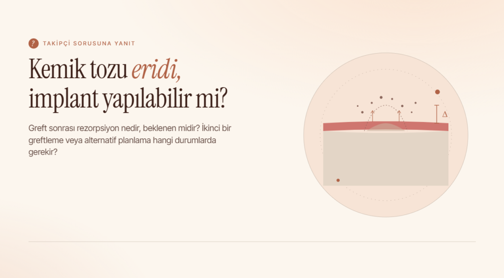 Kemik Tozu Eridi, İmplant Yapılabilir mi?