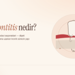 Kronik Periodontitis Nedir? Belirtileri, Nedenleri ve Tedavisi