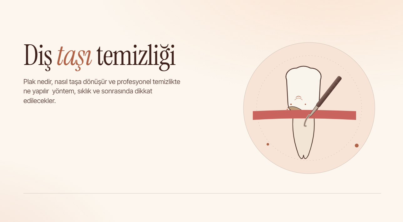 Diş Taşı Temizliği