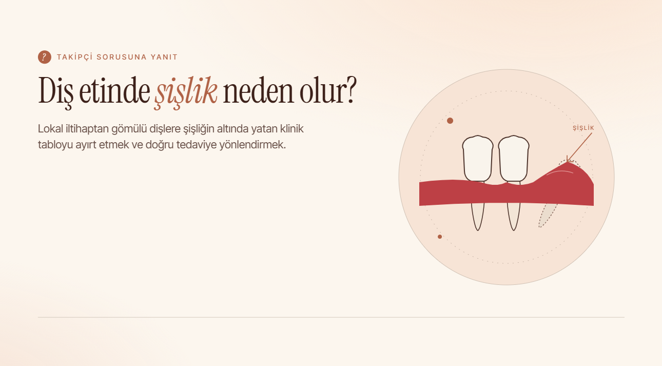Diş Etinde Şişlik Neden Olur?