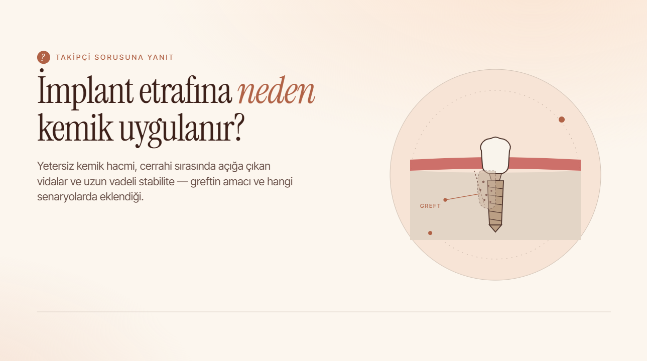 İmplant Etrafına Neden Kemik Uygulanır?