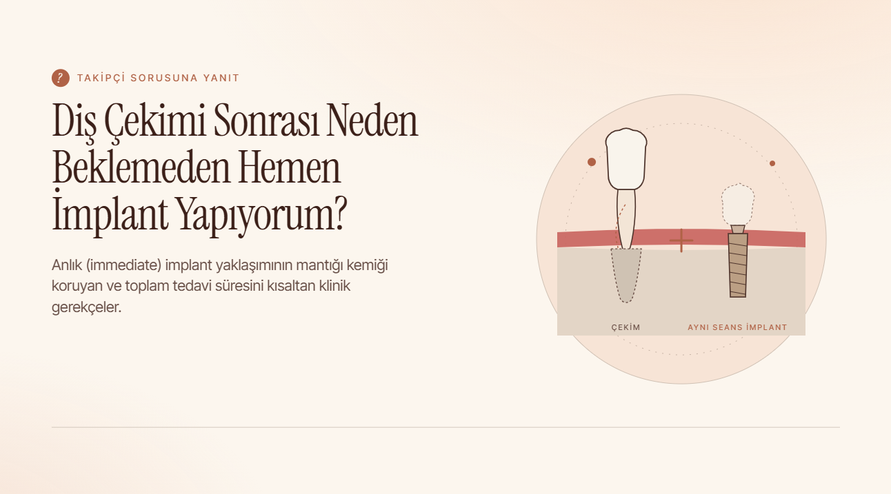 Diş Çekimi Sonrası Neden Beklemeden Hemen İmplant Yapıyorum?