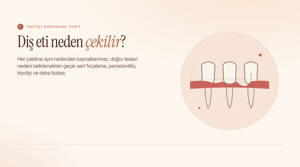 Diş Eti Neden Çekilir? Her Çekilme Aynı Tedaviyle Geçmez