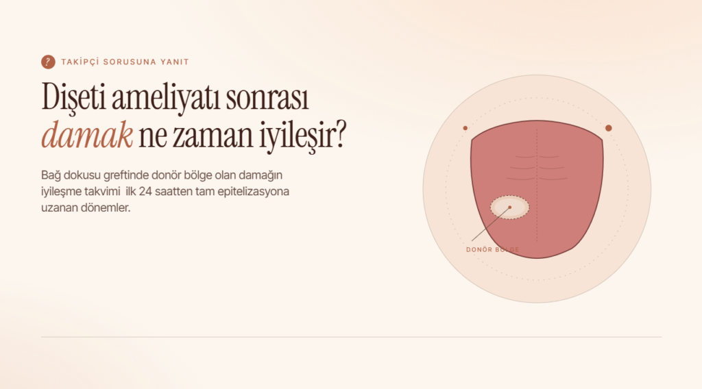 Diş Eti Ameliyatı Sonrası Damak Ne Zaman İyileşir?