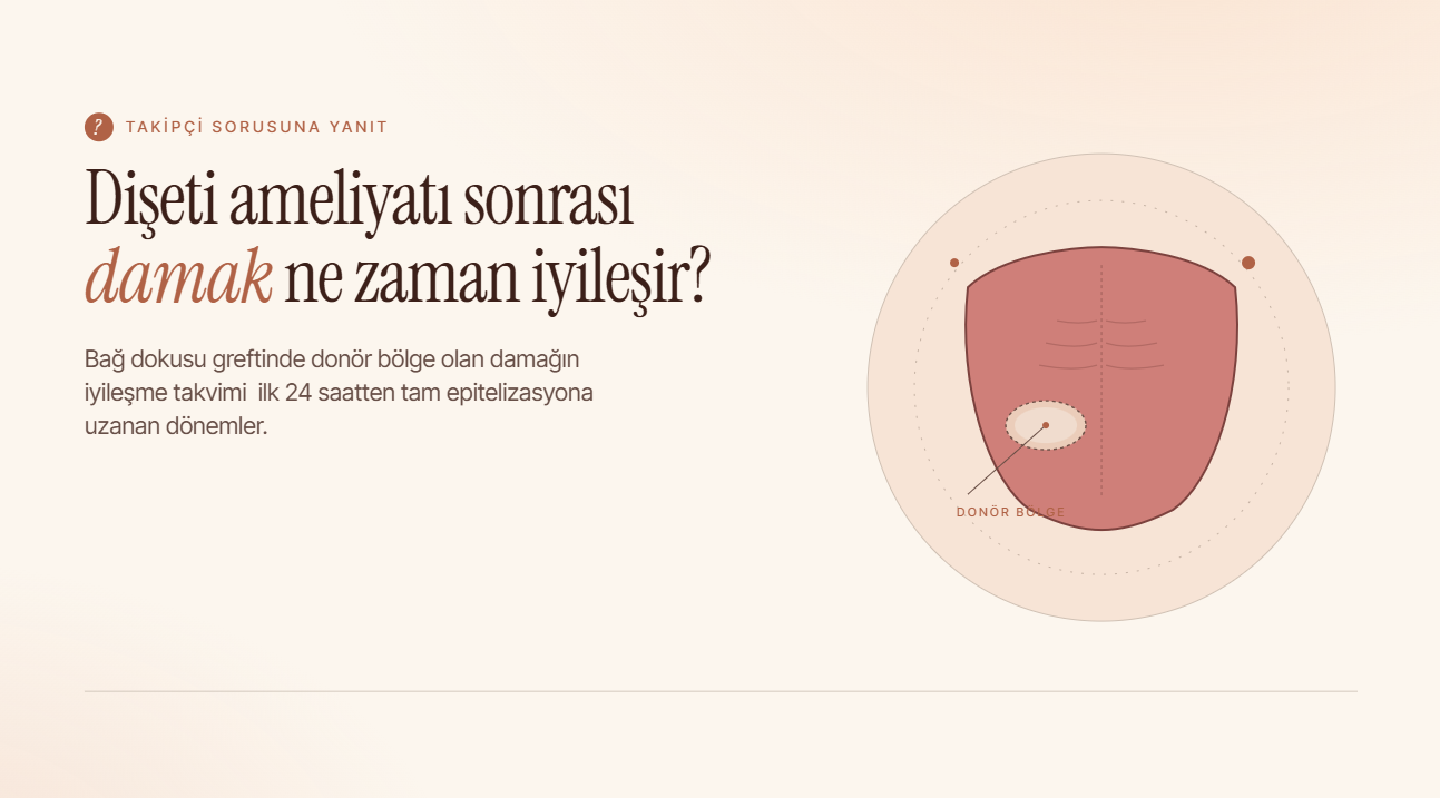 Diş Eti Ameliyatı Sonrası Damak Ne Zaman İyileşir?
