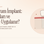 Zirkonyum İmplant Nedir?