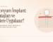 Zirkonyum İmplant Nedir?