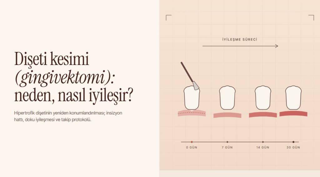 Dişeti Kesimi (Gingivektomi): Neden Yapılır, Nasıl İyileşir?