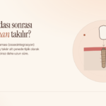 İmplant Vidası Takıldıktan Sonra Diş Ne Zaman Takılır?