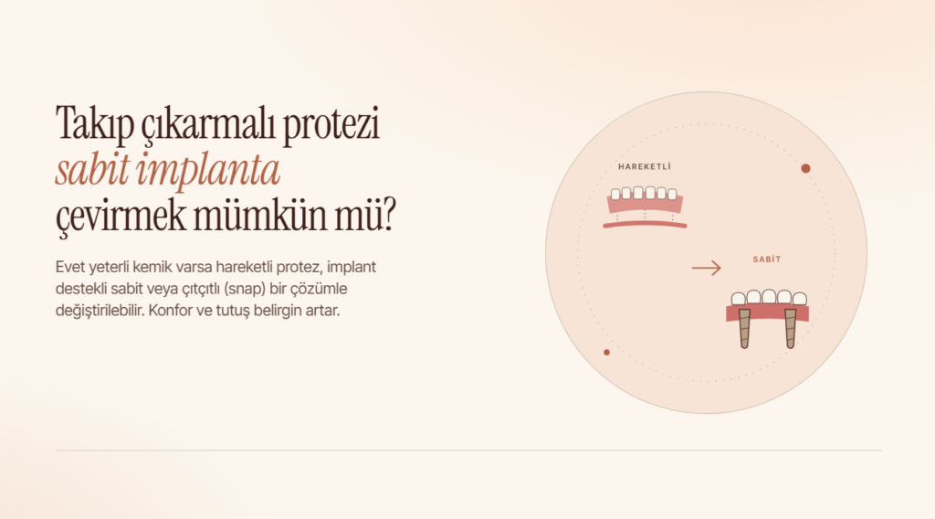 Takıp Çıkarmalı Protezi Sabit İmplanta Çevirmek Mümkün mü?