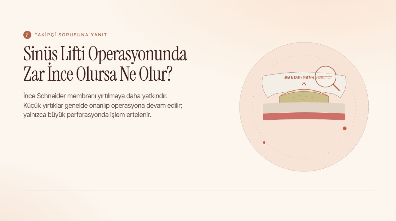 Sinüs Lifti Operasyonunda Zar İnce Olursa Ne Olur?