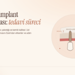 Üst Çene İmplant Uygulaması: Tedavi Süreci