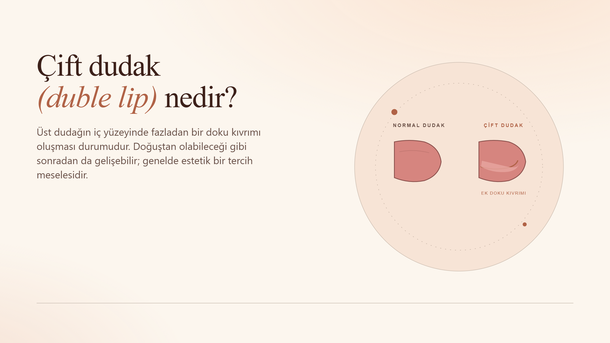 Çift Dudak (Duble Lip) Nedir?