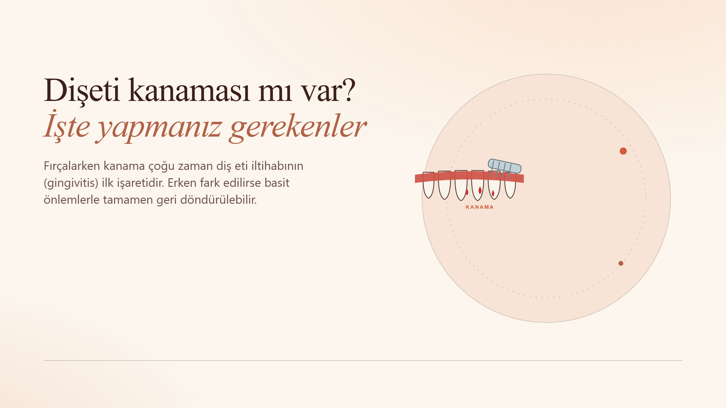 Diş Eti Kanaması mı Var? İşte Yapmanız Gerekenler