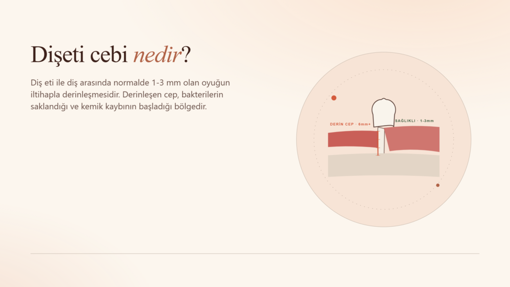 Dişeti Cebi (Periodontal Cep) Nedir?