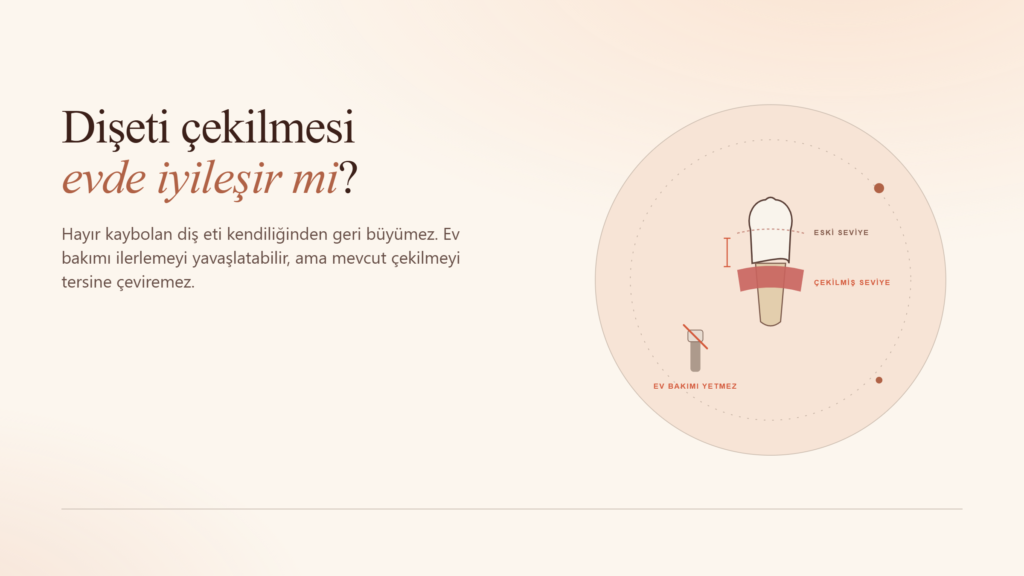 Diş Eti Çekilmesi Evde İyileşir mi?