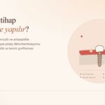 İmplant İltihap Kaparsa Ne Yapılır?