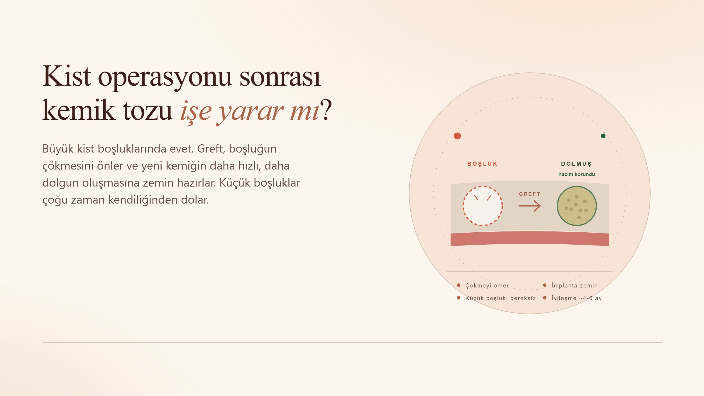 Kist Operasyonu Sonrası Kemik Tozu İşe Yarar mı?