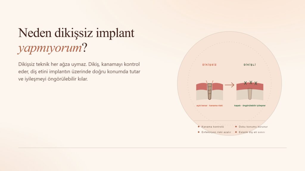 Neden Dikişsiz İmplant Yapmıyorum?