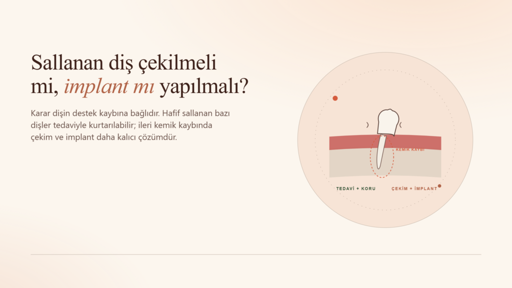 Sallanan Diş Çekilmeli mi İmplant mı Yapılmalı?