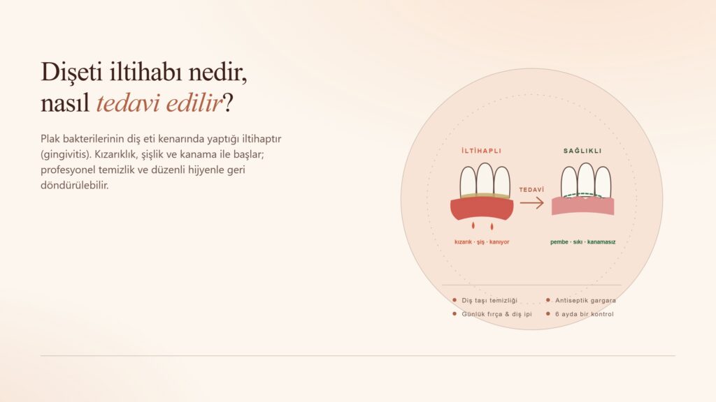 Dişeti İltihabı Nedir, Nasıl Tedavi Edilir?