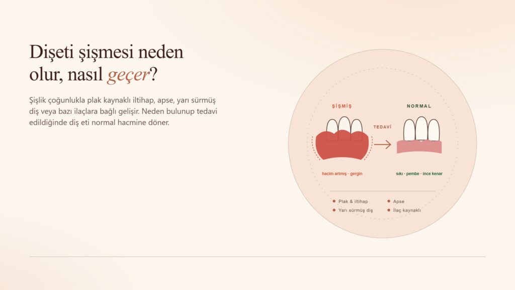 Dişeti Şişmesi Neden Olur, Nasıl Geçer? Uzman Rehberi