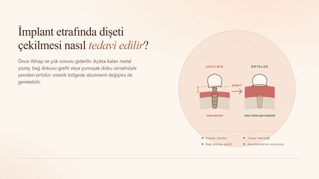 İmplant Etrafında Dişeti Çekilmesi Nasıl Tedavi Edilir?