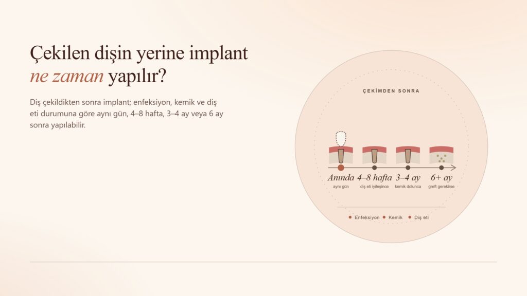 Çekilen Dişin Yerine İmplant Ne Zaman Yapılır?