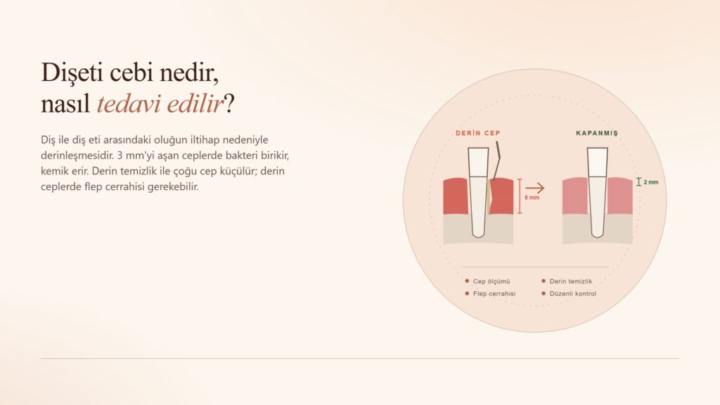 Dişeti Cebi Nedir, Nasıl Tedavi Edilir?