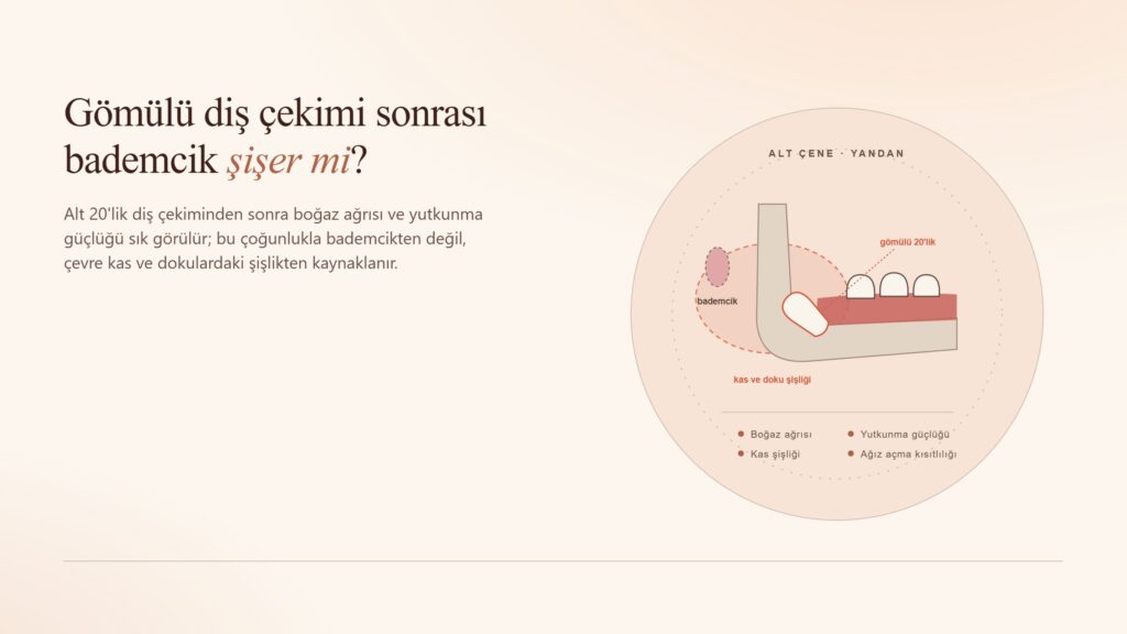 Gömülü Diş Çekimi Sonrası Bademcik Şişer mi?